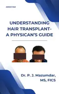 Cover of Understanding Hair Transplant