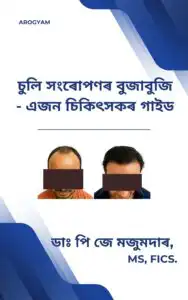 Assamese Understanding hair transplant