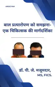 Hindi Understanding Hair Transplant