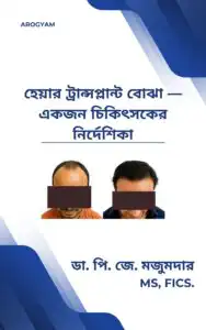 Bengali Understanding Hair Transplant