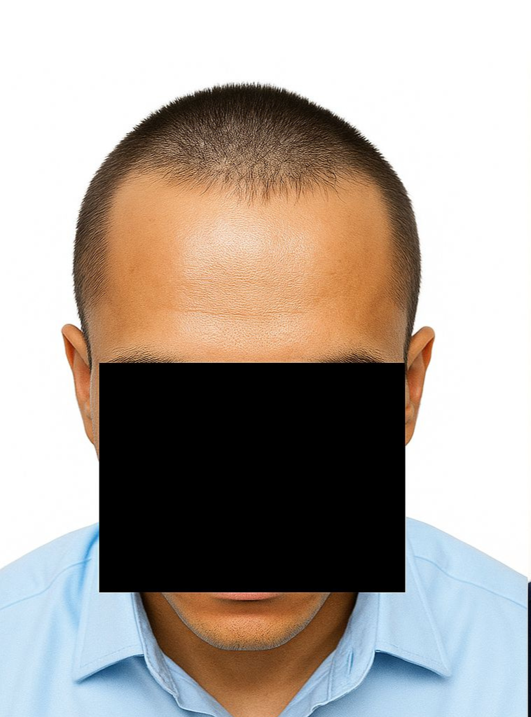 Arogyam Grade 3 Before