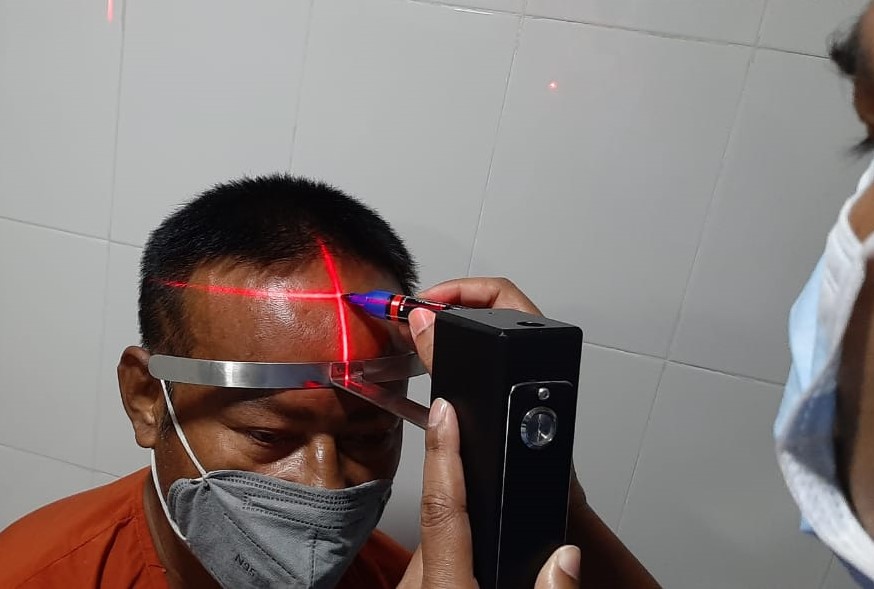 Arogyam Laser Hairline Drawing