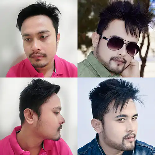 Arogyam Beard Transplant