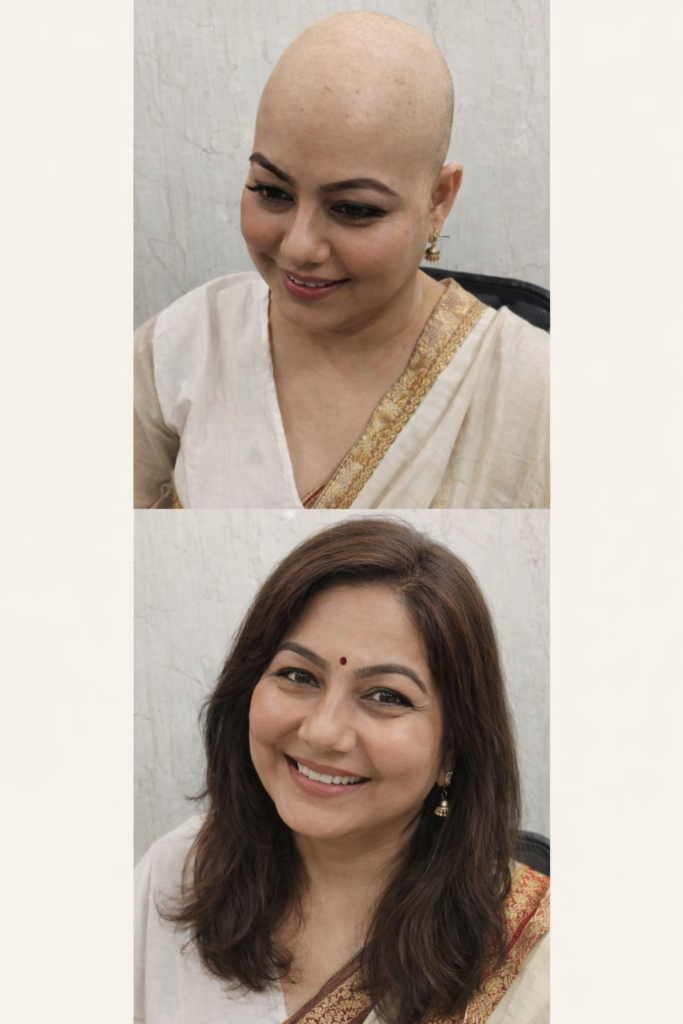 Chemotherapy wigs at Arogyam Guwahati