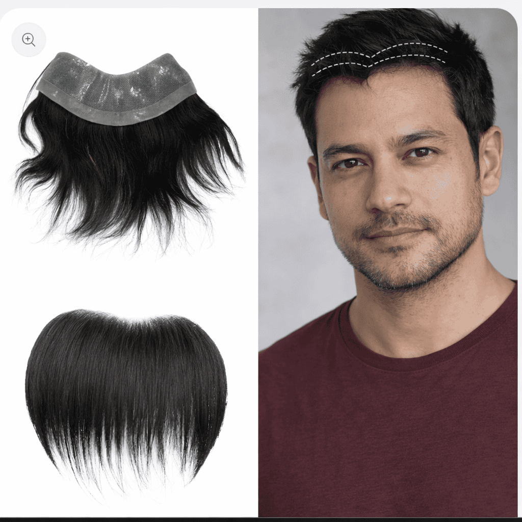 Frontline Hair Patch Arogyam Guwahati