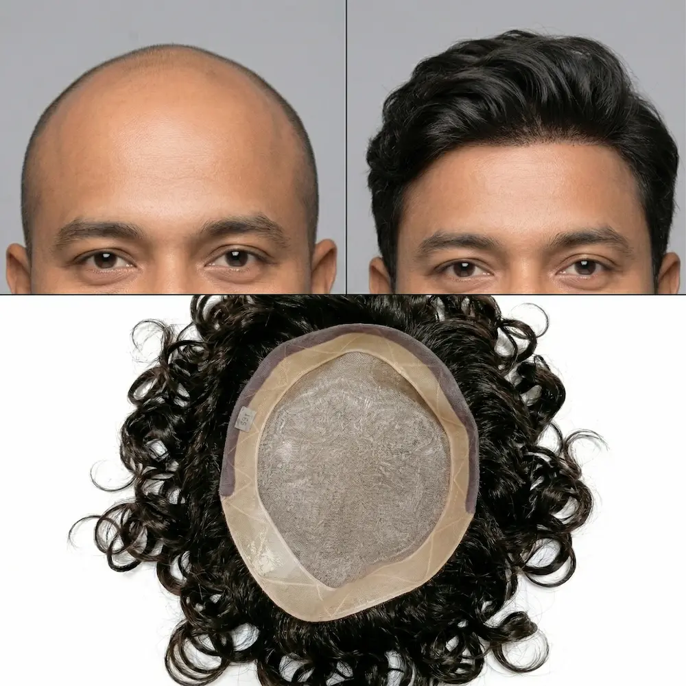 Fine Mono Hair Patch Arogyam