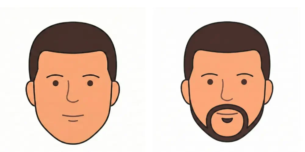 French Type Beard Illustration | Approx 2500 grafts needed